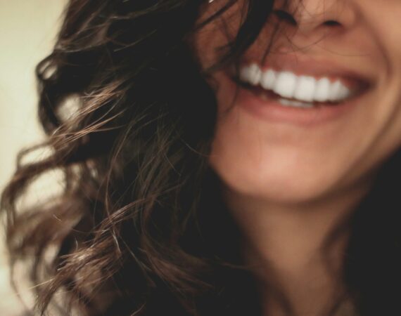 Dental implants restored smile St. Johns, FL