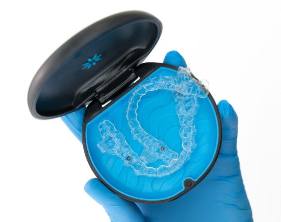 Invisalign solution guide St. Johns FL