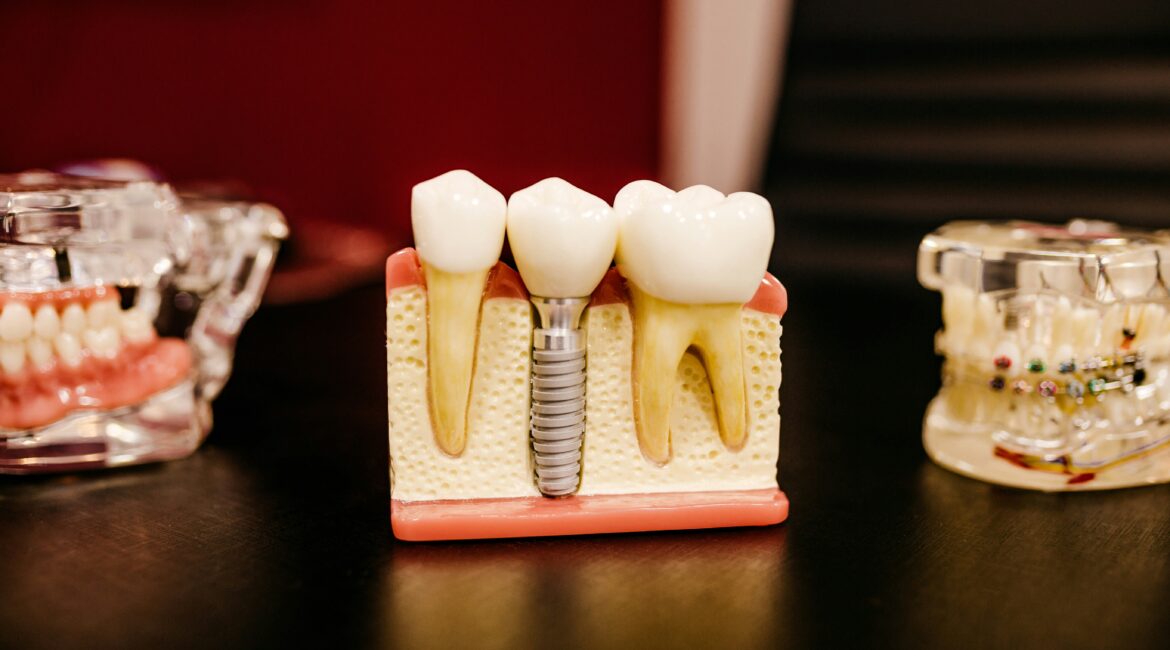 guided vs freehand dental implant