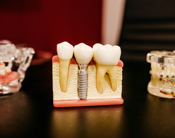 guided vs freehand dental implant
