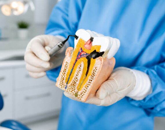 Root canal Jacksonville