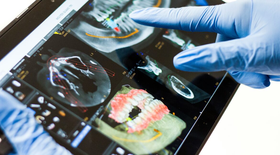 Diabetes and oral health