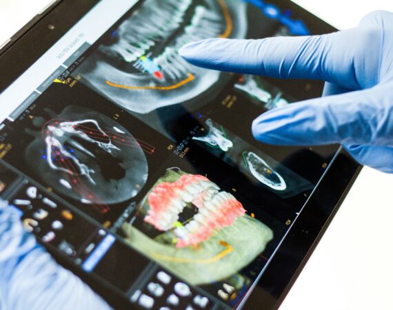 Diabetes and oral health